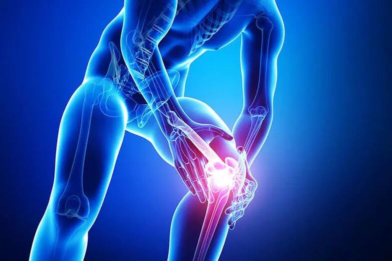 أعراض هشاشة العظام